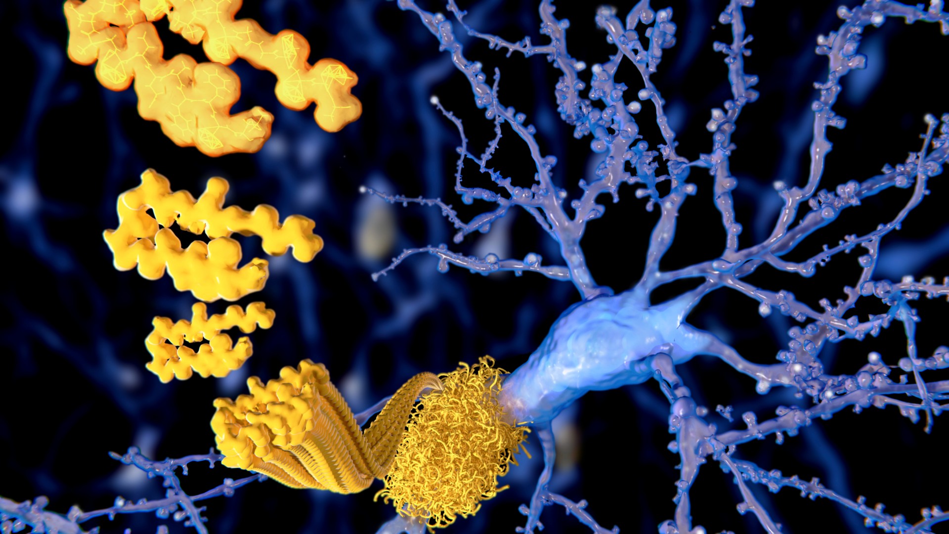 Medical illustration of a neuron, in blue, in the background being surrounded by a plaque of amyloid-beta protein, in yellow with the illustration visualizing how the proteins join together