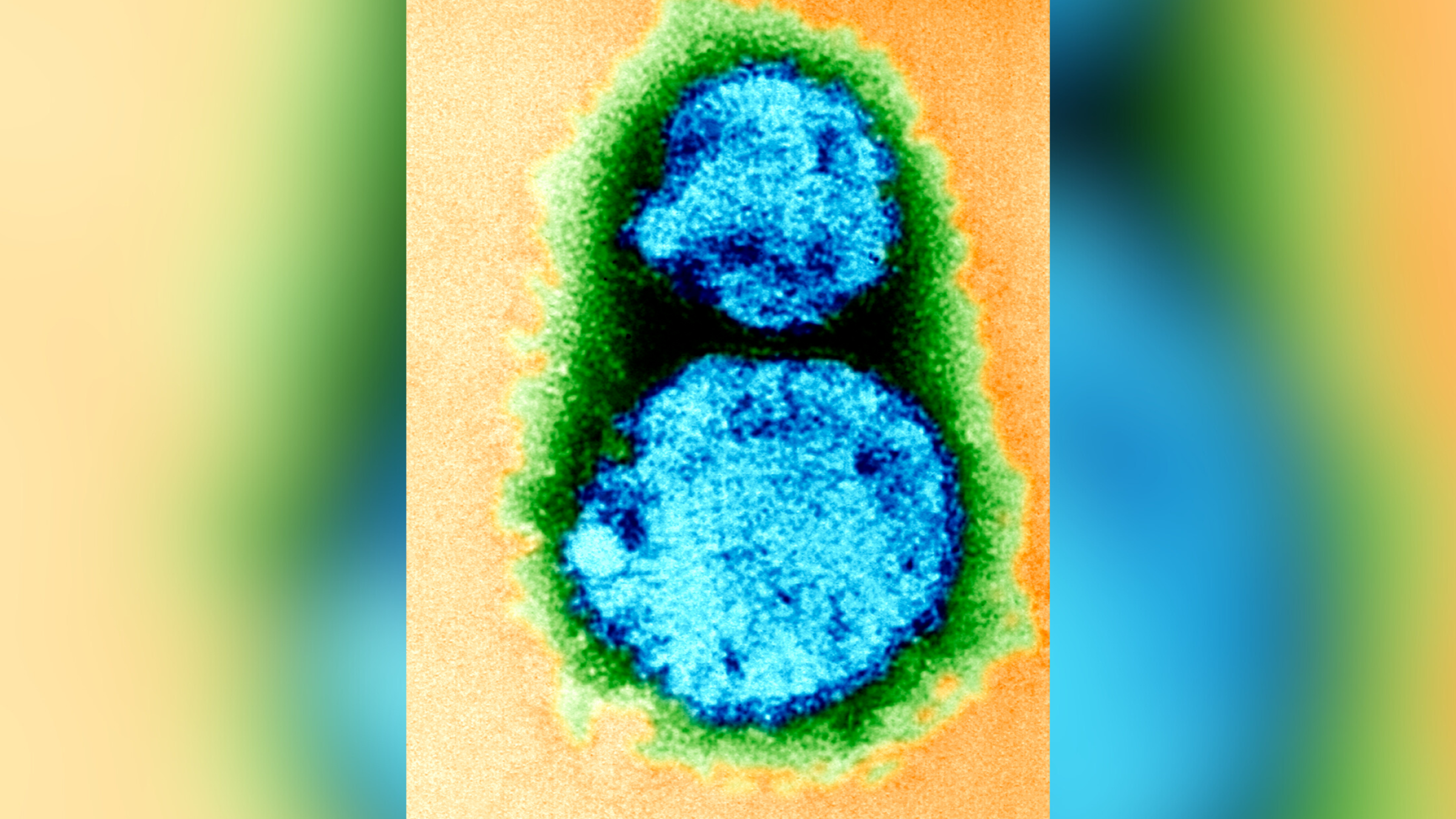 A high-resolution microscope image of a particle of a hantavirus against an enlarged, blurred version of the same image. The virus is blue, green and black.